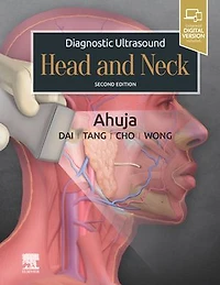 Diagnostic Ultrasound: Head and Neck E-Book: Diagnostic Ultrasound: Head and Neck E-Book