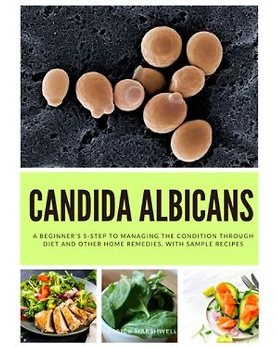 Candida Albicans: A Beginner's 5-Step to Managing the Condition Through Diet and Other Home Remedies, With Sample Recipes