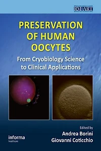 Preservation of Human Oocytes: From Cryobiology Science to Clinical Applications