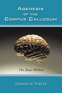 Agenesis Of The Corpus Callosum: Beast Within