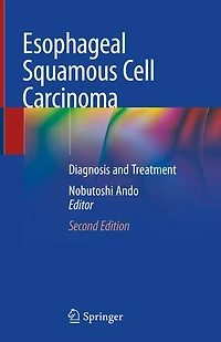 Esophageal Squamous Cell Carcinoma: Diagnosis And Treatment