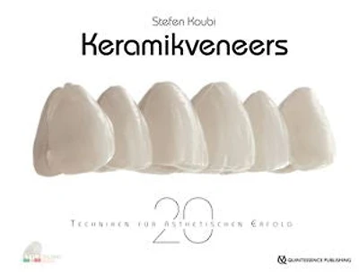 Keramikveneers: 20 Techniken für ästhetischen Erfolg