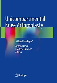 Unicompartmental Knee Arthroplasty: A New paradigm?