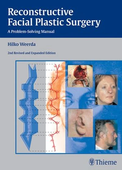 Reconstructive Facial Plastic Surgery: A Problem-Solving Manual