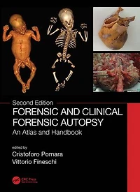 Forensic and Clinical Autopsy: An Atlas Handbook