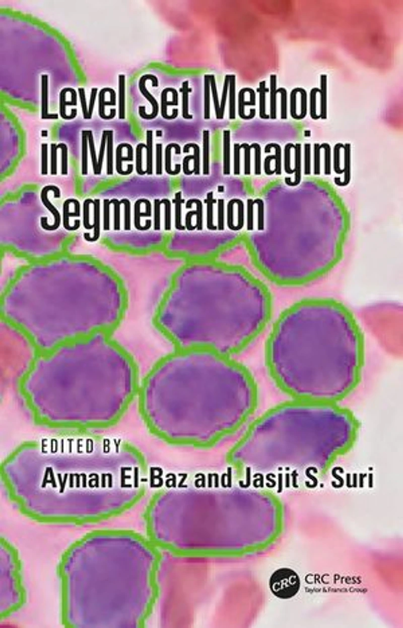 Level Set Method Medical Imaging Segmentation