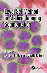 Level Set Method Medical Imaging Segmentation