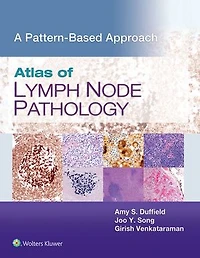 Atlas of Lymph Node Pathology: A Pattern Based Approach