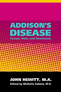 Addison's Disease: Causes, Tests and Treatments