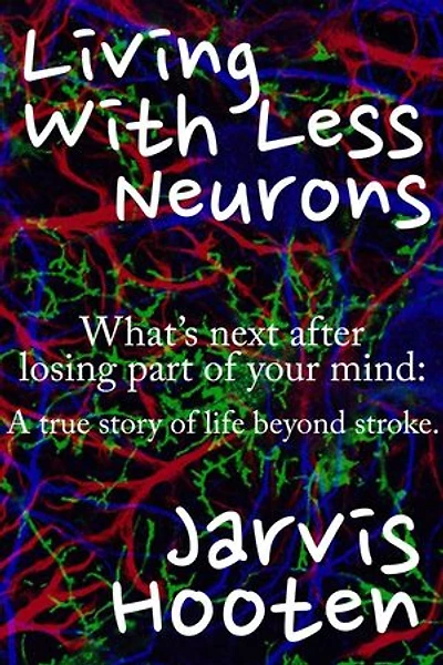 Living With Less Neurons
