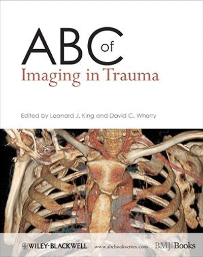 ABC of Imaging Trauma