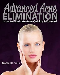 Advanced Acne Elimination: How to eliminate Acne Quickly & Forever!
