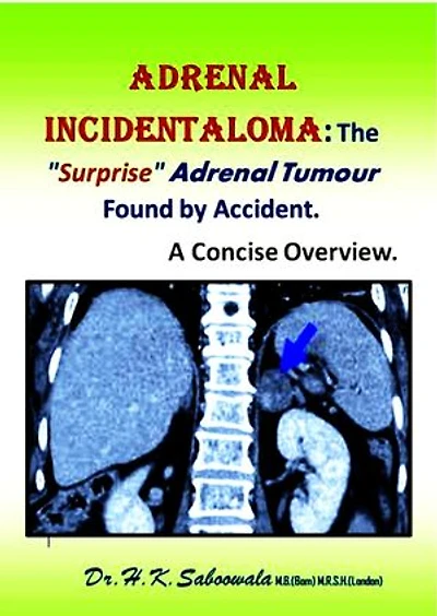 Adrenal Incidentaloma: The "Surprise" Adrenal Tumour Found by Accident. A Concise Overview.