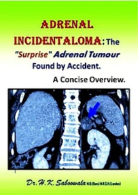 Adrenal Incidentaloma: The "Surprise" Adrenal Tumour Found by Accident. A Concise Overview.