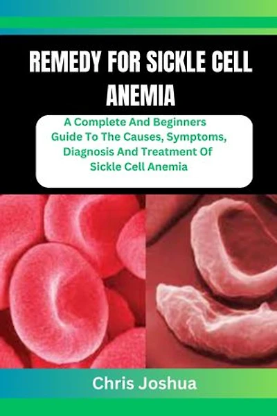 REMEDY FOR SICKLE CELL ANEMIA: A Complete And Beginners Guide To The Causes, Symptoms, Diagnosis And Treatment Of Sickle Cell Anemia