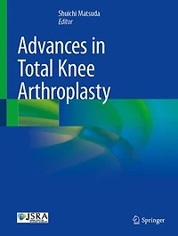 Advances Total Knee Arthroplasty
