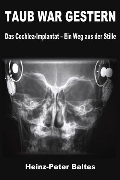 TAUB WAR GESTERN: Das Cochlea-Implantat – Ein Weg aus der Stille