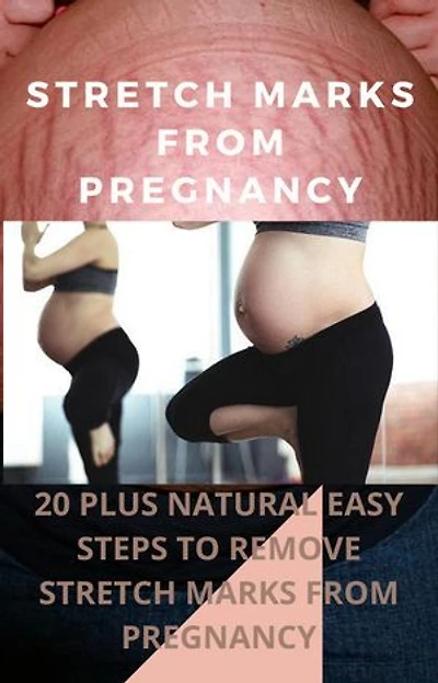 20 PLUS EASY STEPS TO REMOVE STRETCH MARKS FROM PREGNANNT
