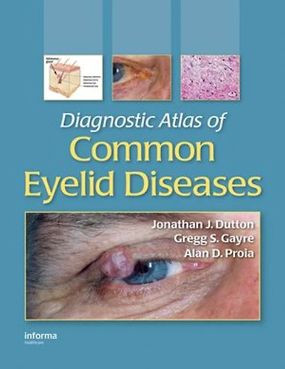 Diagnostic Atlas of Common Eyelid Diseases