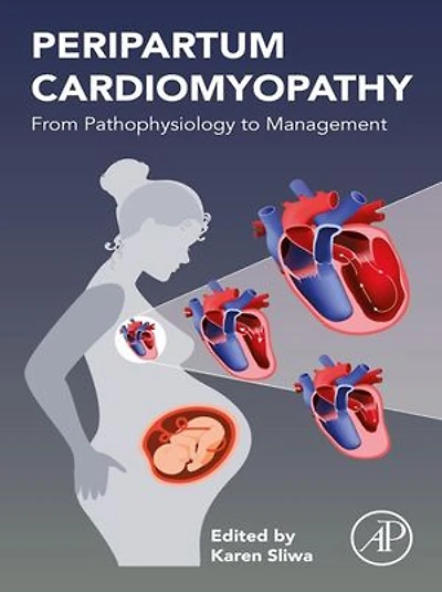 Peripartum Cardiomyopathy: From Pathophysiology To Management