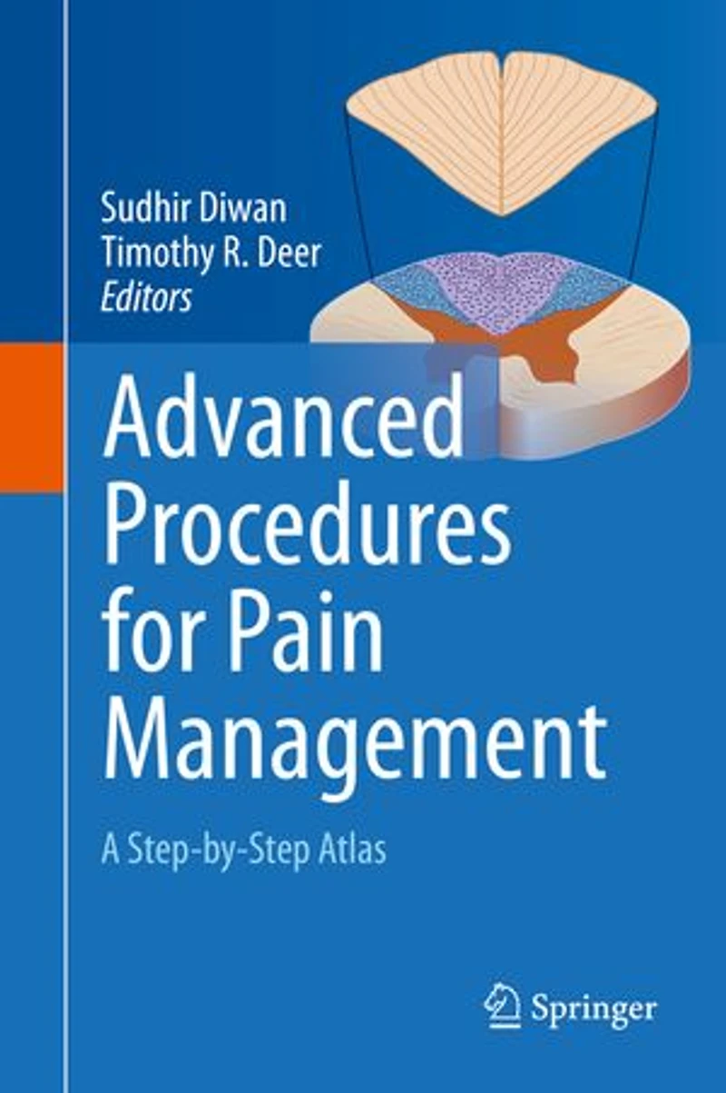 Advanced Procedures for Pain Management: A Step-by-Step Atlas