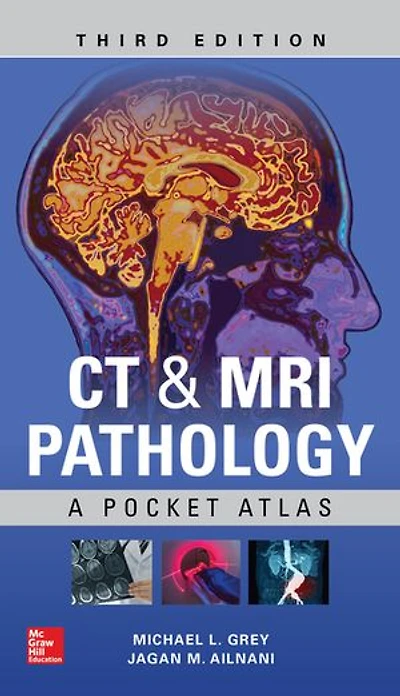 CT & MRI Pathology: A Pocket Atlas, Third Edition