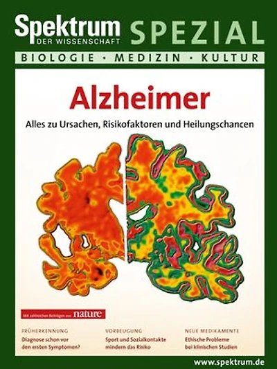 Alzheimer: Alles zu Ursachen, Risikofaktoren und Heilungschancen