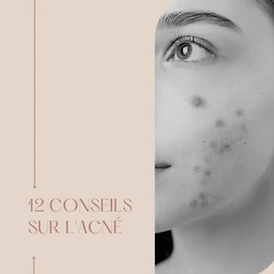 12 conseils pour l'acné