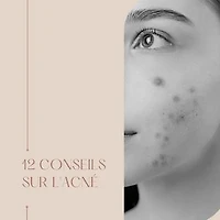 12 conseils pour l'acné