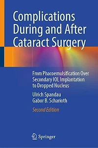 Complications During and After Cataract Surgery: A Guide to Surgical Management
