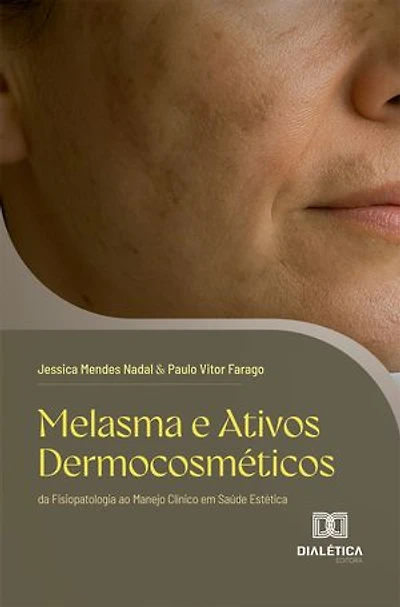 Melasma e Ativos Dermocosméticos: da Fisiopatologia ao Manejo Clínico em Saúde Estética