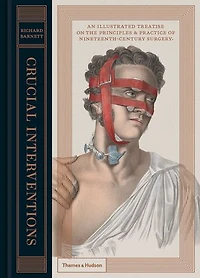 Crucial Interventions: An Illustrated Treatise of the Principles&Practice 19th Century Surgery