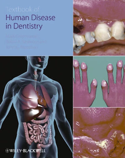 Essentials of Human Disease Dentistry