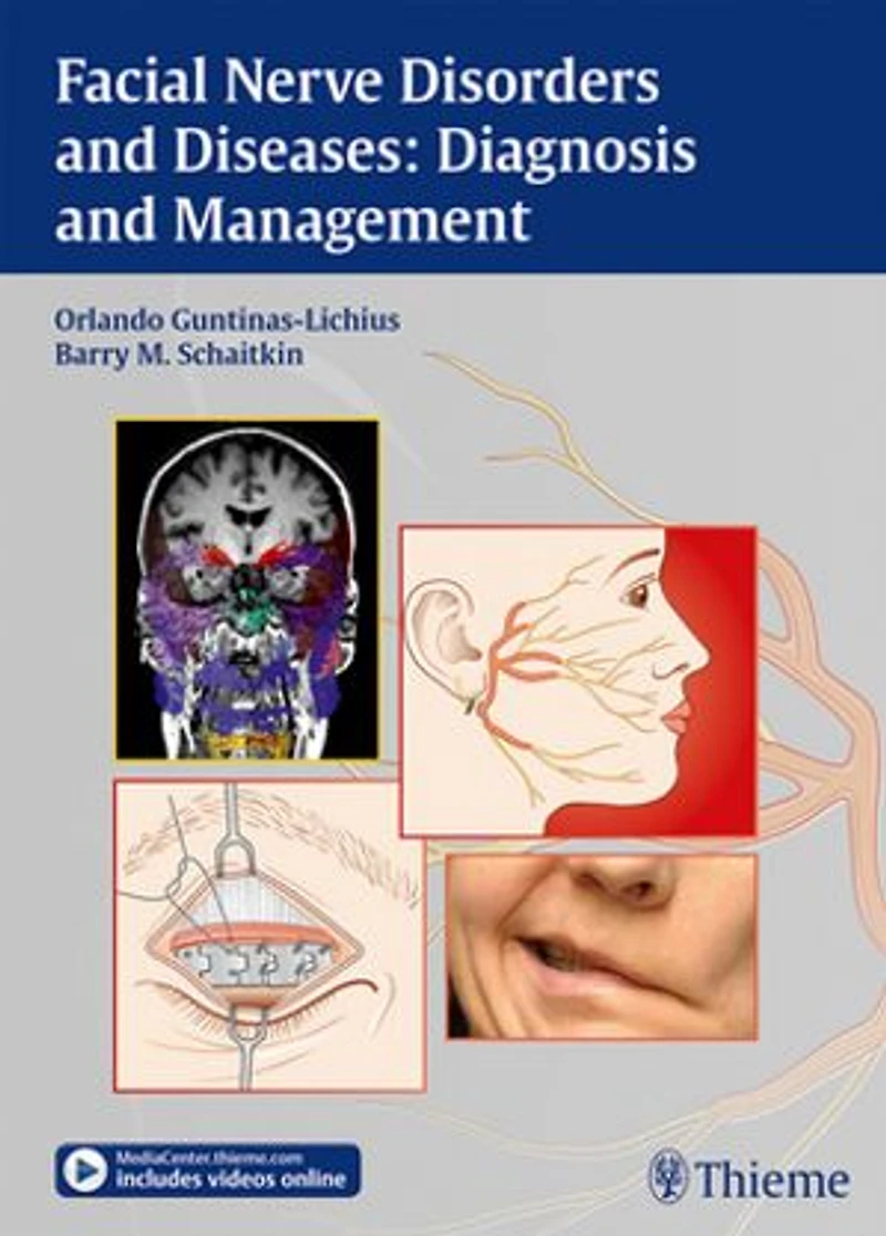 Facial Nerve Disorders And Diseases: Diagnosis Management