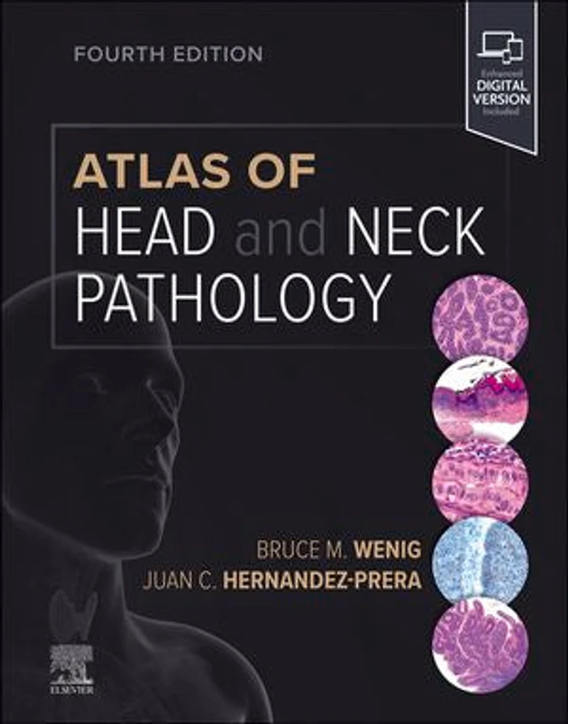 Atlas Of Head And Neck Pathology