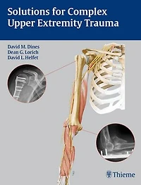 Solutions for Complex Upper Extremity Trauma
