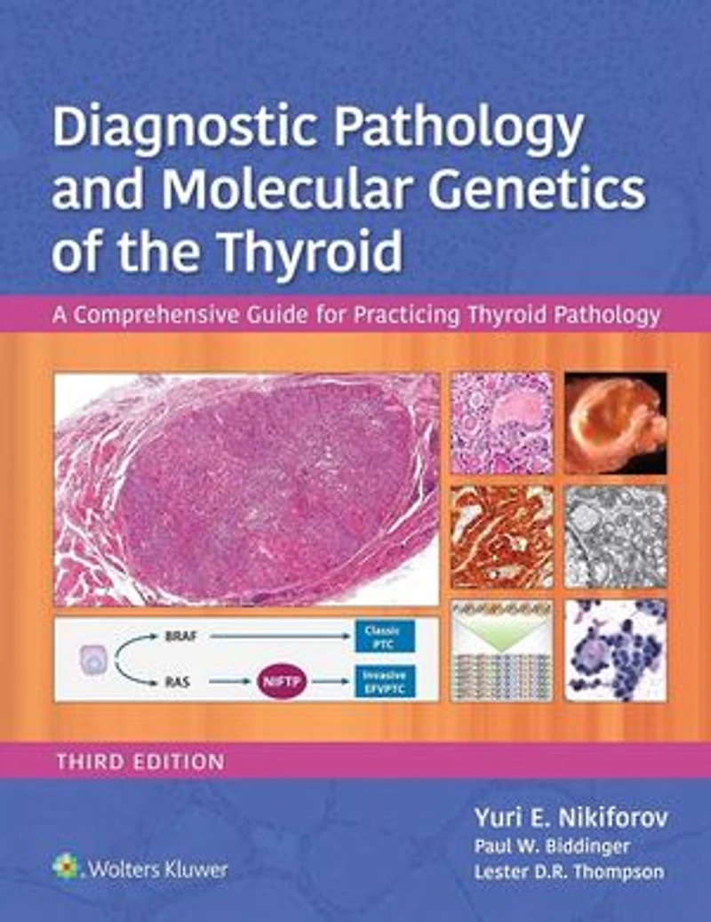 Diagnostic Pathology and Molecular Genetics of the Thyroid: A Comprehensive Guide for Practicing Thyroid