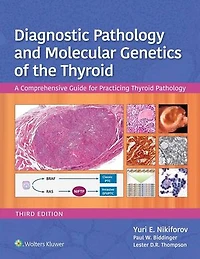 Diagnostic Pathology and Molecular Genetics of the Thyroid: A Comprehensive Guide for Practicing Thyroid