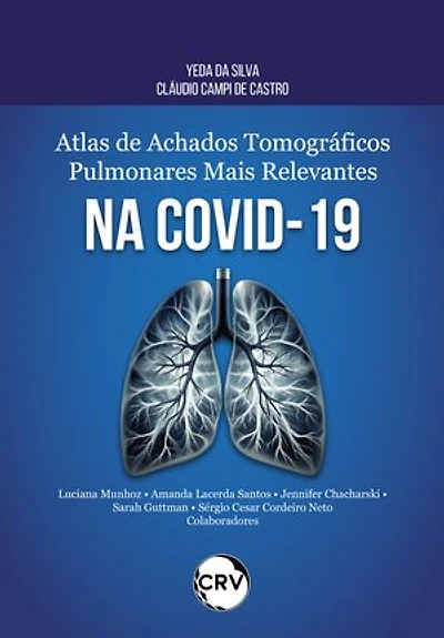 Atlas de achados tomográficos pulmonares mais relevantes na COVID-19