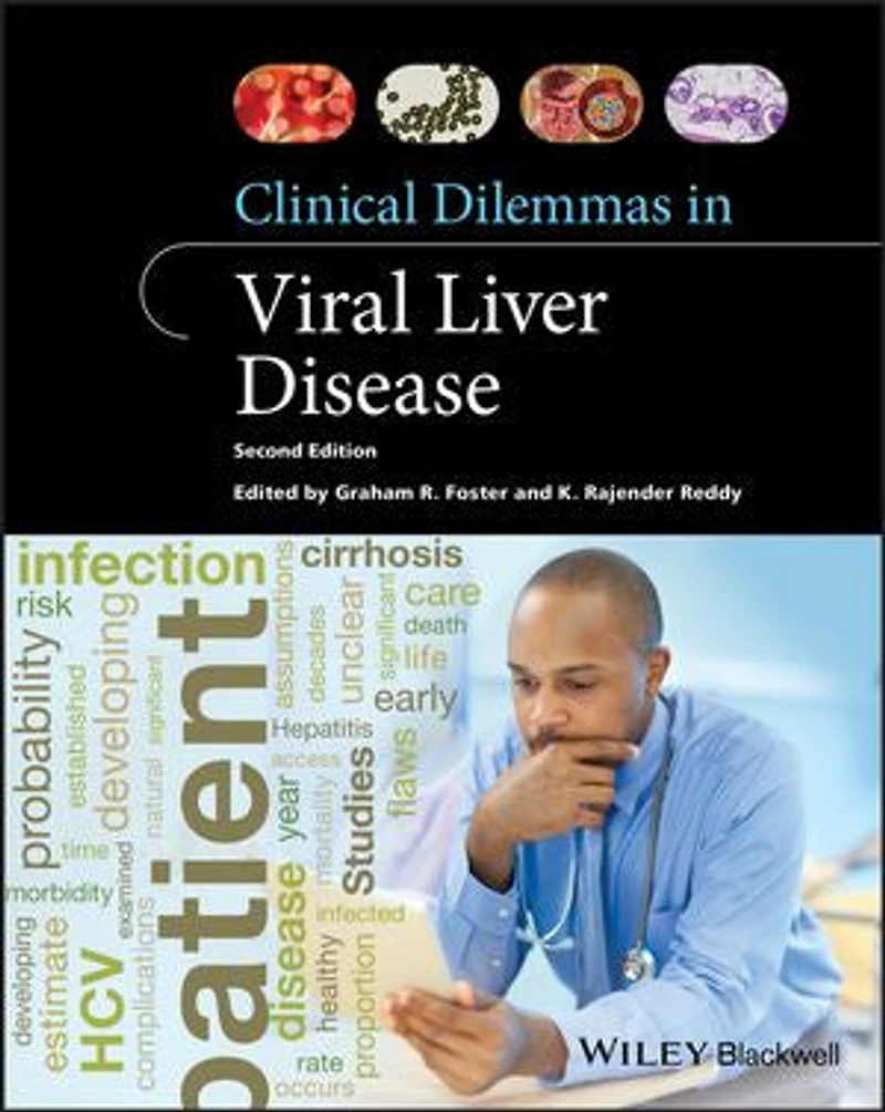 Clinical Dilemmas Viral Liver Disease