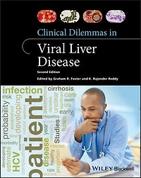 Clinical Dilemmas Viral Liver Disease
