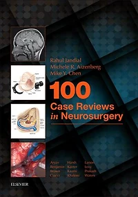 100 Case Reviews in Neurosurgery E-Book