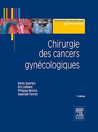 Chirurgie des cancers gynécologiques