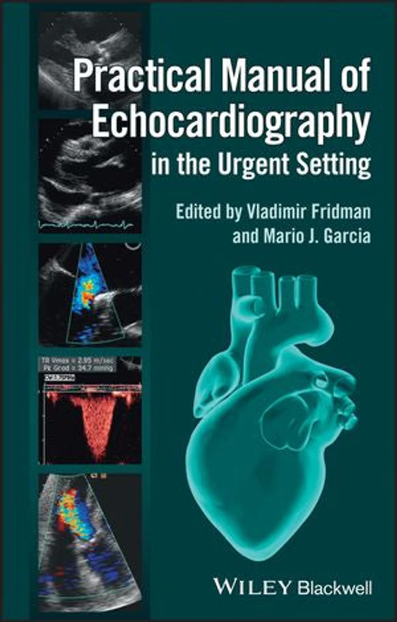 Practical Manual of Echocardiography the Urgent Setting