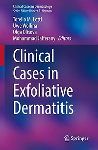 Clinical Cases Exfoliative Dermatitis