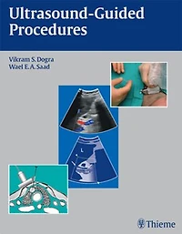 Ultrasound-Guided Procedures