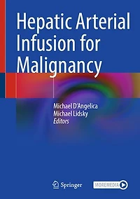 Hepatic Arterial Infusion for Malignancy