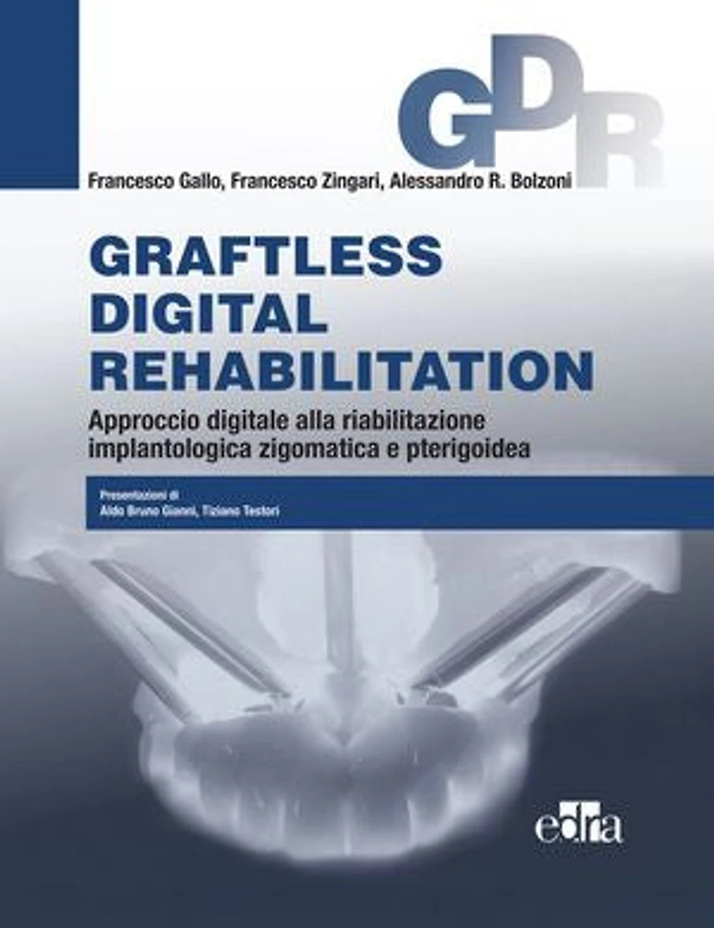 Graftless digital rehabilitation: Approccio digitale alla riabilitazione implantologica zigomatica e pterigoidea
