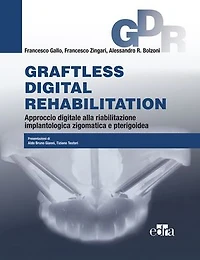 Graftless digital rehabilitation: Approccio digitale alla riabilitazione implantologica zigomatica e pterigoidea