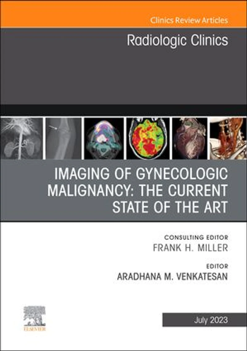 Imaging of Gynecologic Malignancy: the Current State Art, An Issue Radiologic Clinics North America